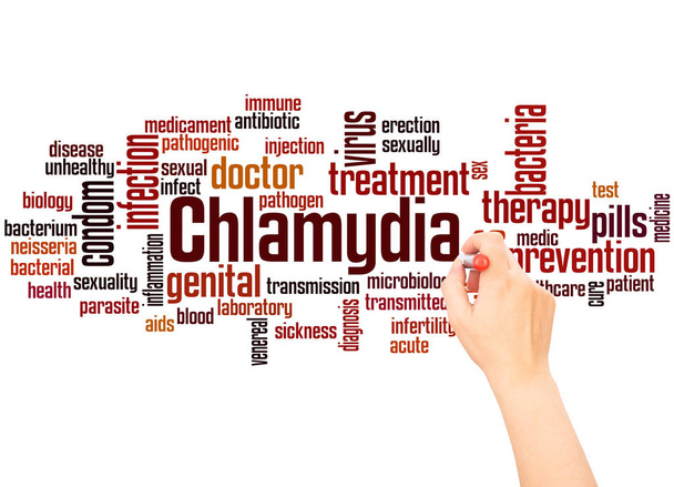 Chlamydien-Wortwolke und Handschrift-Konzept auf Gradienten-Hintergrund. - Foto, Bild
