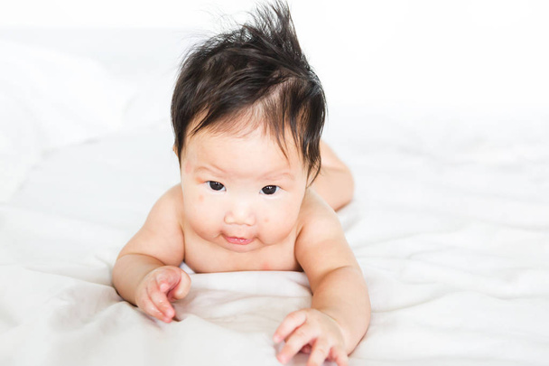 Asian baby girl with red spots on skin face - Foto, Bild