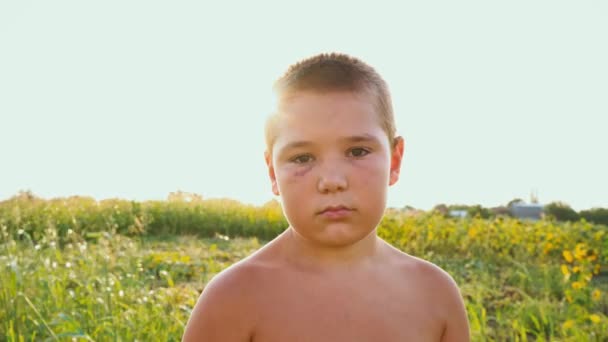 Portret van een mollig jongen met een black-eye op de achtergrond van een groen veld, een verdrietig kind met een naakte torso en een blauwe plek op zijn gezicht - Video