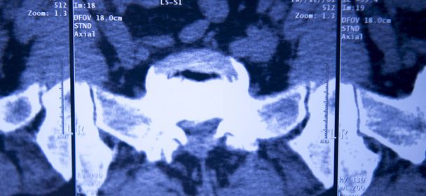 Radiografía de hospital médico caderas columna pelvis resonancia magnética traumatología
. - Foto, Imagen