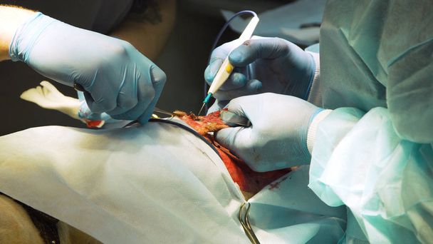 Chirurgische ingreep van een hond in een dierenkliniek - Foto, afbeelding