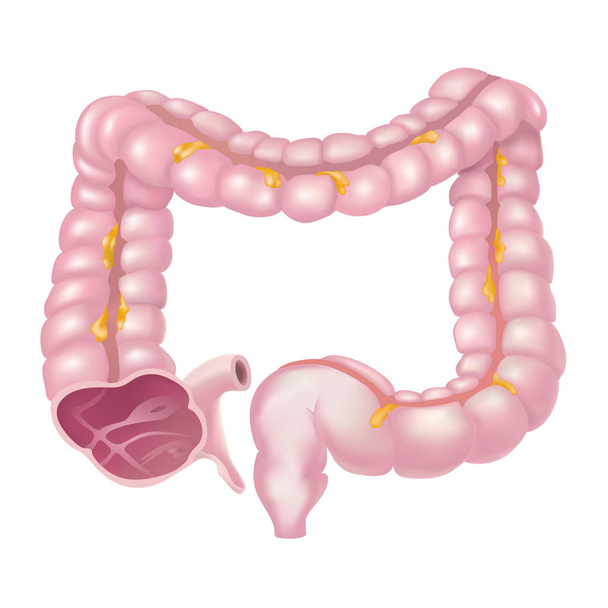 El intestino grueso, también llamado colon, es parte de las etapas finales de la digestión.
 - Vector, imagen