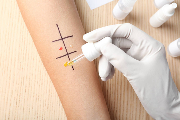 Doctor making allergy test at table, top view - Foto, Imagem