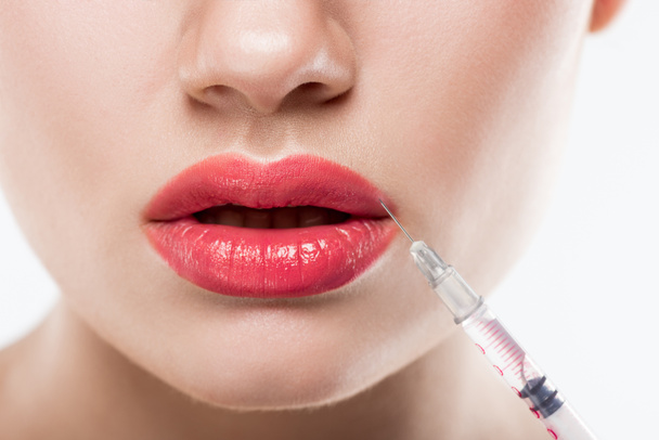 visión parcial de la mujer con jeringa haciendo inyección de belleza en los labios, aislada en blanco
 - Foto, Imagen