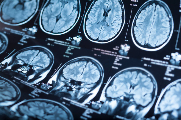 Medical x-ray of human brain, closeup image - Foto, imagen