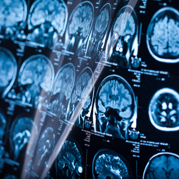 Medical x-ray of human brain, closeup image - Foto, Imagem