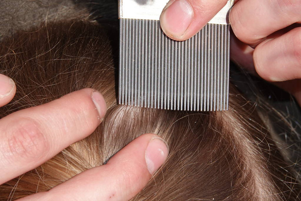 Vérification des cheveux d'une jeune fille pour les poux de tête
 - Photo, image