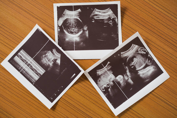 Ultrason tarama raporu, hamile kadının ahşap masa üzerinde Kapat. - Fotoğraf, Görsel