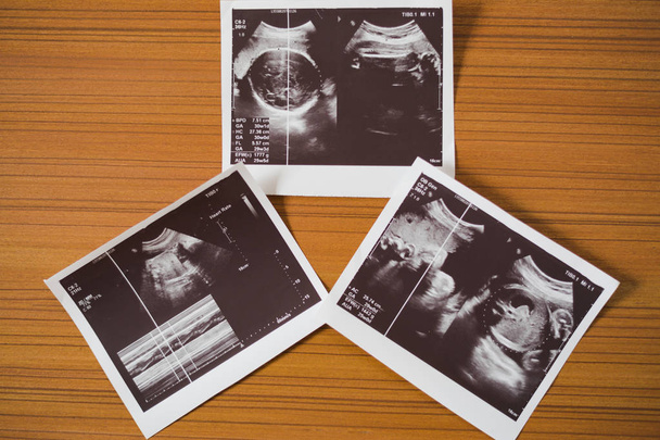 Közelkép ultrahang vizsgálat jelentés a terhes nő a fa tábla. - Fotó, kép