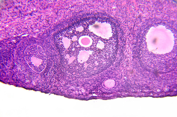 micrografía de ovario que muestra folículos primarios, primarios y secundarios aislados sobre fondo blanco
. - Foto, Imagen