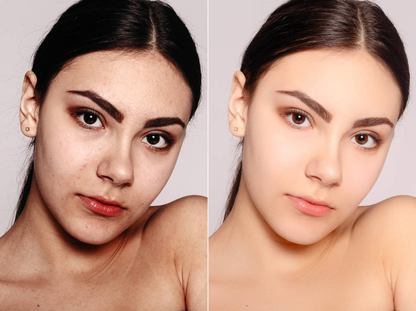 egészség, emberek, ifjúság és szépség koncepció - kozmetikai műtét előtt és után. Fiatal csinos nő portré. Kozmetikai vagy plasztikai beavatkozás előtt és után korcsökkentő kezelés, kezelés - Fotó, kép