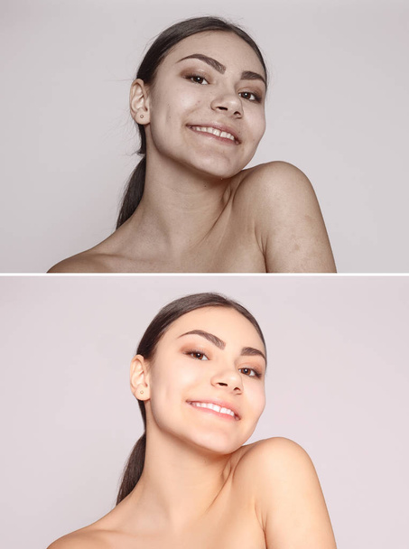 Sağlık, insan, gençlik ve güzellik kavramı - önce ve sonra kozmetik işlemi. Genç güzel kadın portre. Önce ve sonra kozmetik veya plastik yordamı Anti-yaş terapi, tedavi - Fotoğraf, Görsel