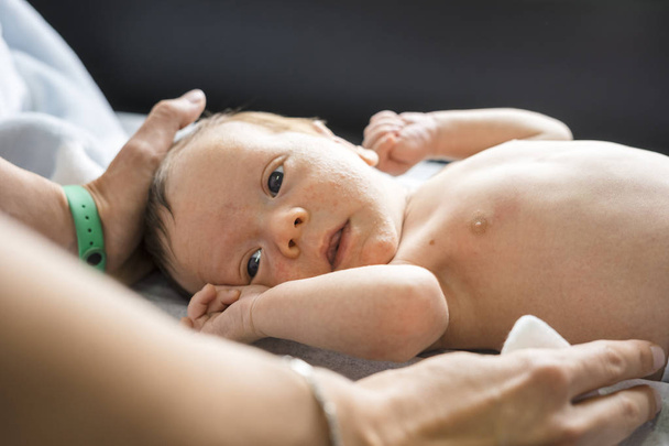 Cara de niño recién nacido con muchas espinillas en la cara asistida por su madre
 - Foto, Imagen