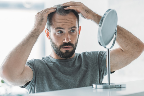 Szakállas közepén felnőtt férfi alopecia nézett tükörbe, haj veszteség koncepció - Fotó, kép