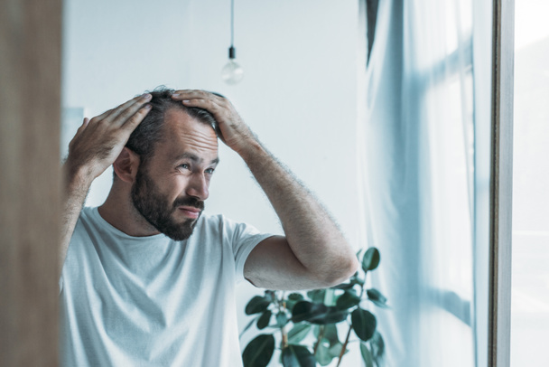 Расстроенный мужчина средних лет с алопецией, смотрящий на зеркало, концепция выпадения волос - Фото, изображение