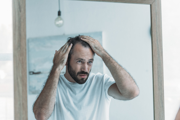 Mann mittleren Alters mit Haarausfall im Spiegel  - Foto, Bild