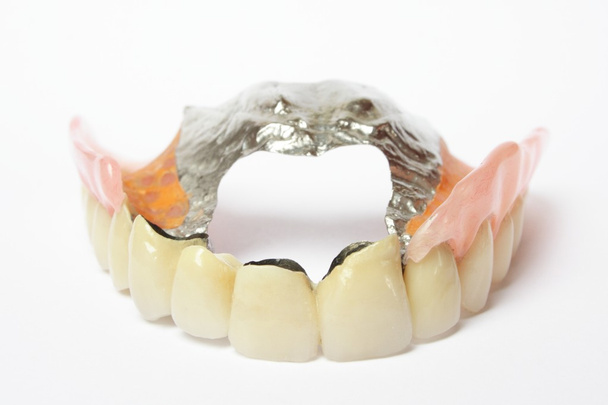 ψεύτικα δόντια (οδοντοστοιχία, στέμμα, γέφυρα) - Φωτογραφία, εικόνα