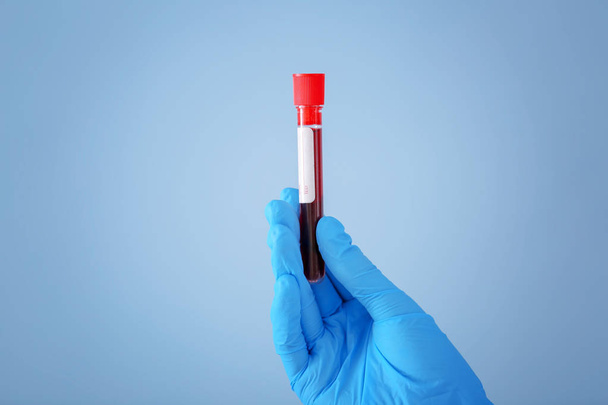 Лаборант держит пробирку с образцом крови на цветном фоне
 - Фото, изображение