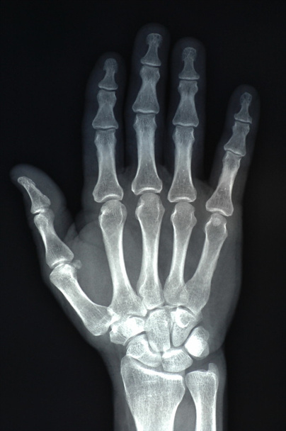 röntgenkuvaus - Valokuva, kuva