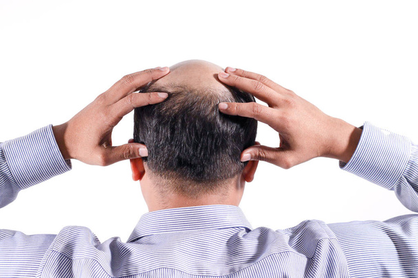 Glatzköpfiger Geschäftsmann mit Kopf auf Kopfhaut von hinten mit weißem Hintergrund - Foto, Bild