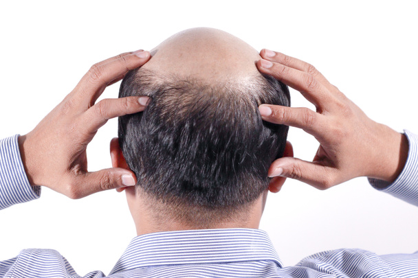 homem de negócios careca com a cabeça na vista do couro cabeludo por trás com fundo branco
 - Foto, Imagem