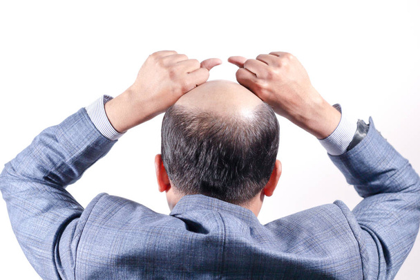 Glatzköpfiger Geschäftsmann mit Kopf auf Kopfhaut von hinten mit weißem Hintergrund - Foto, Bild