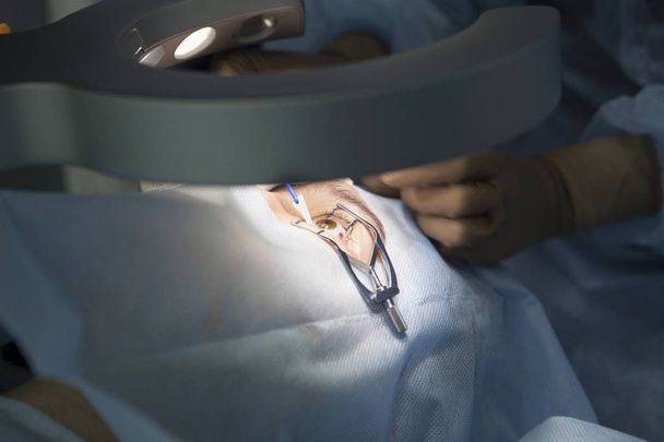 Лазерная хирургия для коррекции зрения и удаления катаракты
 - Фото, изображение