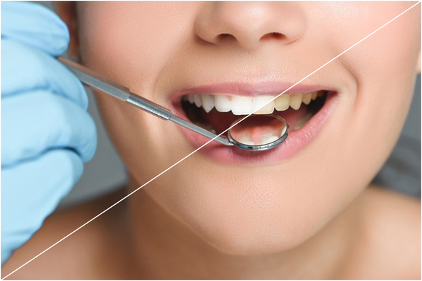 částečný pohled zubař zubní zrcadlem kontrola zubů šťastná žena, bělení zubů koncept - Fotografie, Obrázek