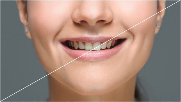gedeeltelijke weergave van lachende vrouw met mooie witte tanden geïsoleerd op grijs, tanden whitening concept - Foto, afbeelding