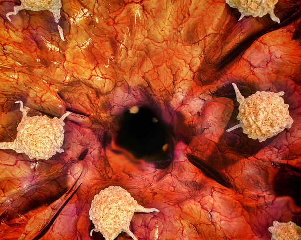Cancer cells, 3d illustration - Photo, Image