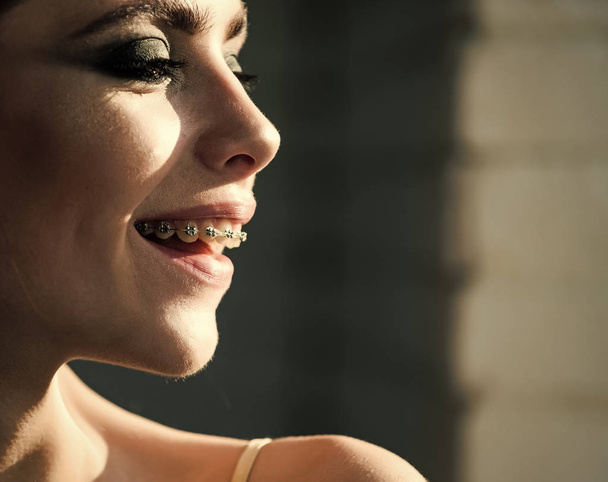 Woman with braces on teeth smile - Foto, afbeelding