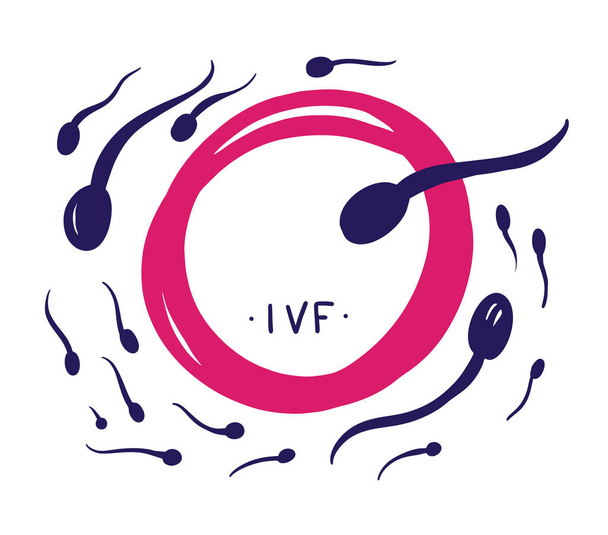 IVF. In Vitro-fertilisatie. Spermogram. Hand getekende vectorillustratie. - Vector, afbeelding