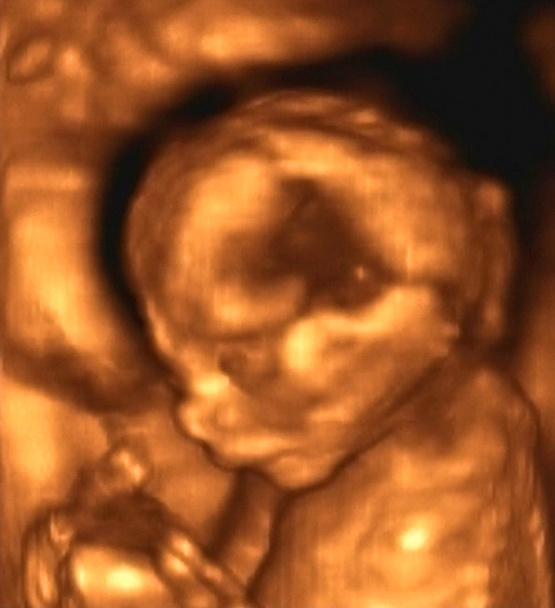 Ultraschalluntersuchung eines Fötus im 4. Monat - Foto, Bild