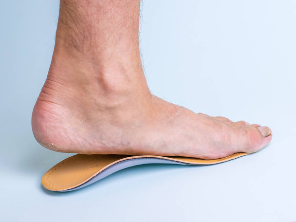 La pierna izquierda de un hombre con signos de pies planos fuertes y plantilla ortopédica sobre un fondo azul. Fotos de enfermedades de los pies
. - Foto, Imagen