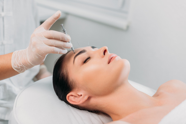 vista parziale del cosmetologo che mette l'ago sulla fronte delle donne durante la terapia di agopuntura nel salone termale
 - Foto, immagini