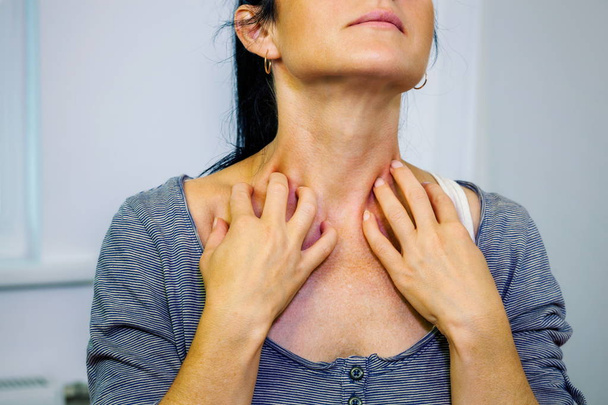 Женщина чешет зудящую шею
 - Фото, изображение