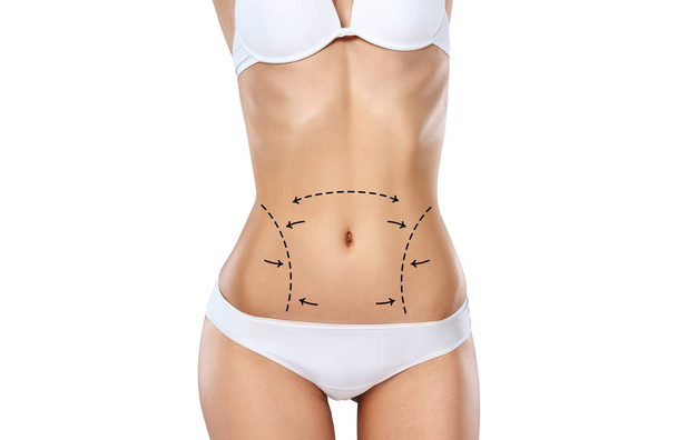 Studio HD capture of a unrecognizable young woman torso in underwear with the drawing arrows and medical marks. Fat lose, liposuction, cellulite removal and skin lifting concept. - Foto, Imagen