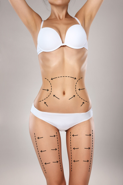 Studio HD capture of a unrecognizable young woman torso in underwear with the drawing arrows and medical marks. Fat lose, liposuction, cellulite removal and skin lifting concept. - Φωτογραφία, εικόνα