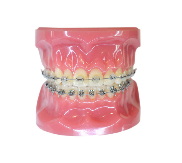Ortodontik diş modelleri diş eğitim modeli jaws ile yarım seramik ve yarım metal braketi diş ve çene modelleri - Fotoğraf, Görsel