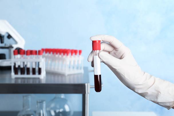Doctor sosteniendo tubo de vidrio con sangre en el laboratorio, primer plano. Prueba de alergia
 - Foto, imagen