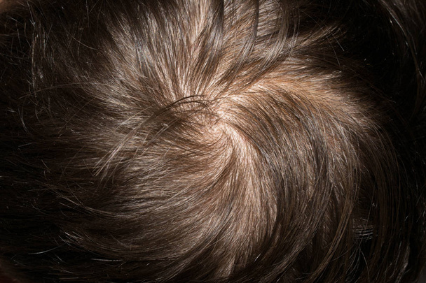 Vlasy na hlavě člověka tenké křehké vzácné prollysiny pro medicínu design pozadí zpět - Fotografie, Obrázek