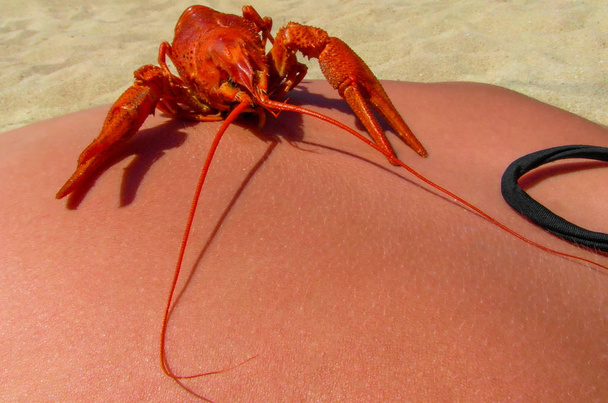 Cancer bouilli sur la plage sur le dos de la fille
 - Photo, image