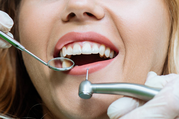 a recepción a fogorvos. vizsgálat a fogorvosnál. fogtömés. szép mosoly - Fotó, kép