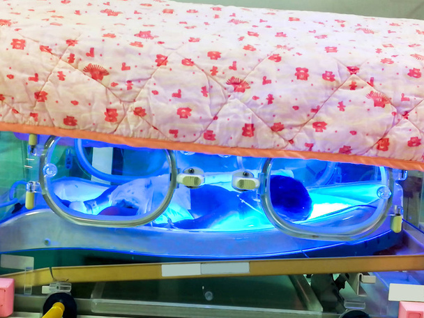 Bebé recién nacido enfermo que duerme en la caja de la unidad de fototerapia para el tratamiento de la hiperbilirrubinemia neonatal y la ictericia neonatal en las salas de la UCIN
. - Foto, Imagen