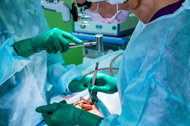 Cirujano y su asistente realizando cirugía estética en la nariz en el quirófano del hospital. Remodelación de la nariz, aumento. Rinoplastia
. - Foto, Imagen