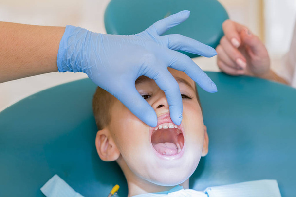 Il dentista sta curando i denti di un maschio.Odontoiatria infantile, Odontoiatria pediatrica. Una stomatologa donna sta curando i denti di un ragazzo in età scolare. Igiene e salute orale
. - Foto, immagini