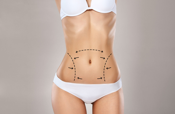 Studio HD capture of a unrecognizable young woman torso in underwear with the drawing arrows and medical marks. Fat lose, liposuction, cellulite removal and skin lifting concept. - Photo, Image