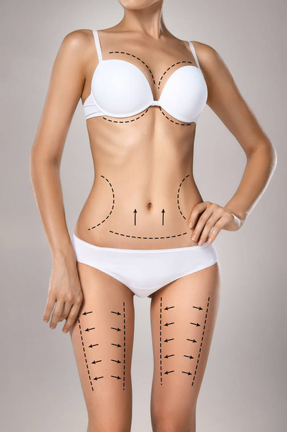Studio HD capture of a unrecognizable young woman torso in underwear with the drawing arrows and medical marks. Fat lose, liposuction, cellulite removal and skin lifting concept. - Foto, Bild