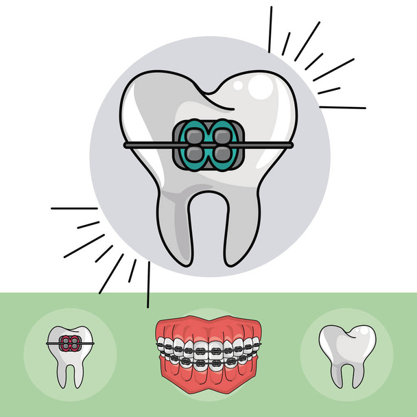 歯ブレース要素 - ベクター画像