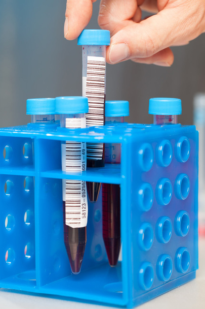 Blood In tube for laboratory analysis - Foto, Imagem